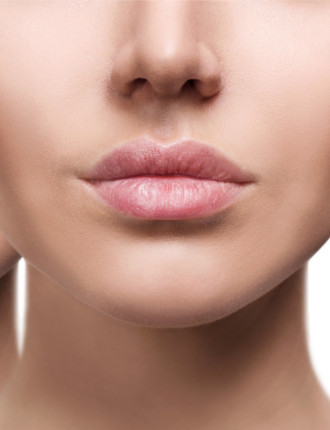 dermal fillers